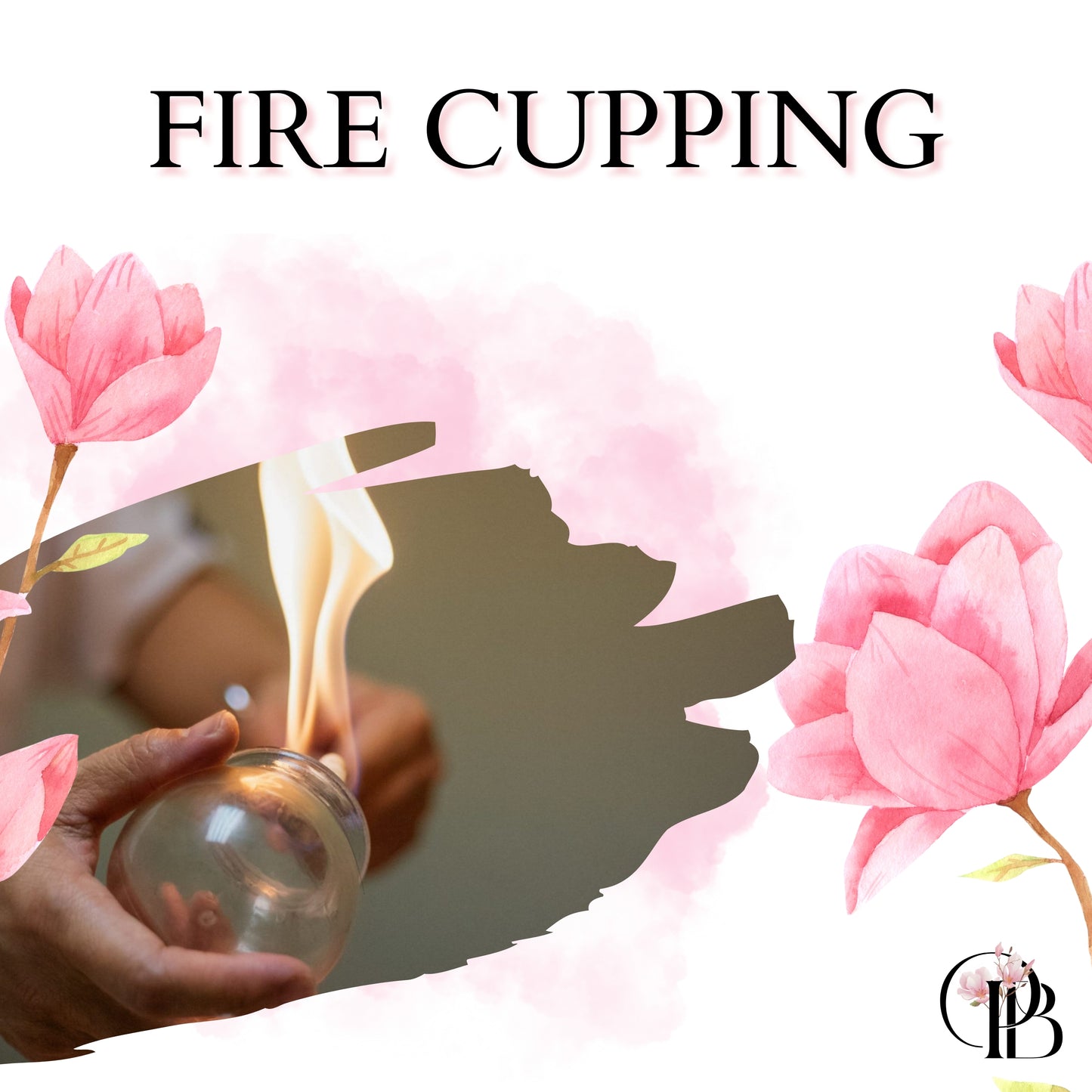Fire Cupping